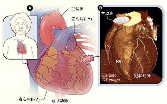 冠心病需要做哪些檢查？(圖2)